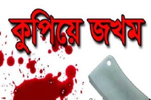 কুপিয়ে ছাত্রলীগের দুইকর্মীর হাত-পা কাটলো দুর্বৃত্তরা