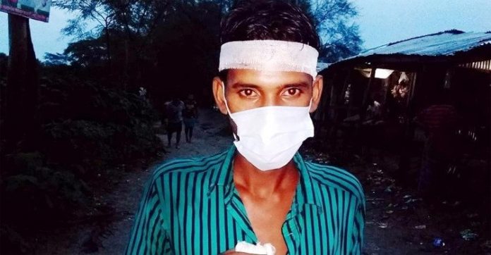 টিকা নিতে এসে মারধর খেয়ে টিকা না নিয়েই বাড়ি ফিরতে হলো ...