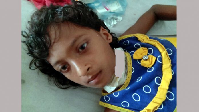 ১০ বছরের শিশুকন্যার গলায় ছুরি চালালেন মা